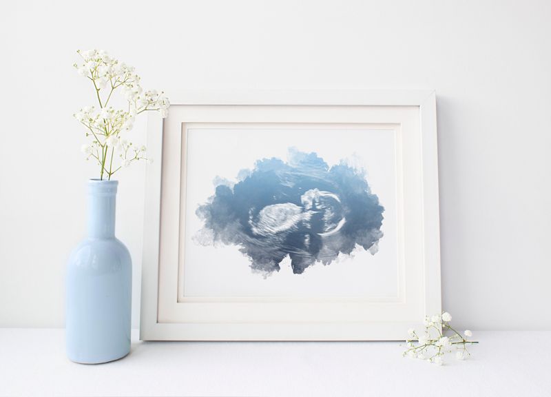 Ultrasound Art with Watercolor Gradient