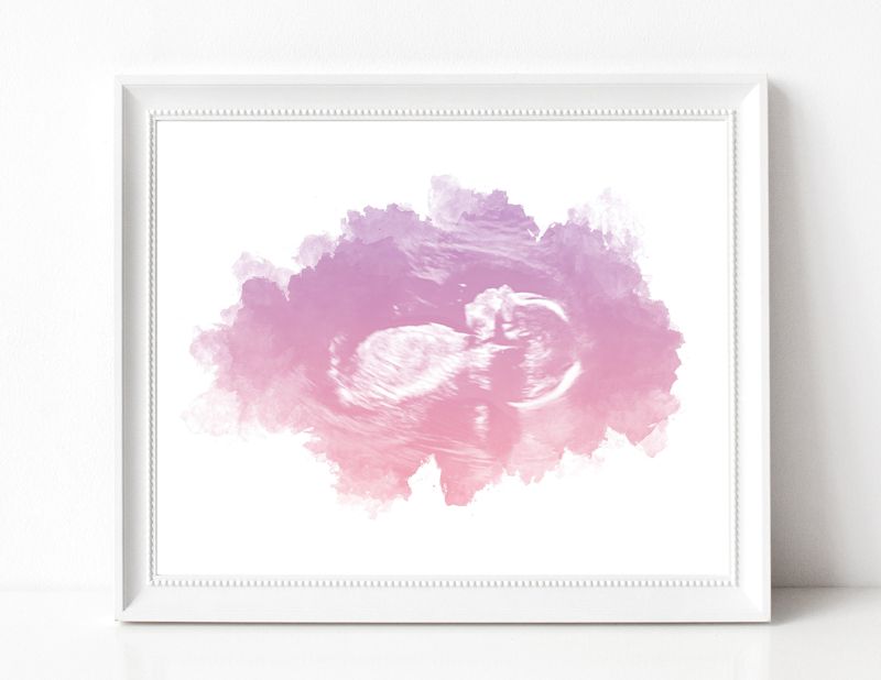 Ultrasound Art with Watercolor Gradient