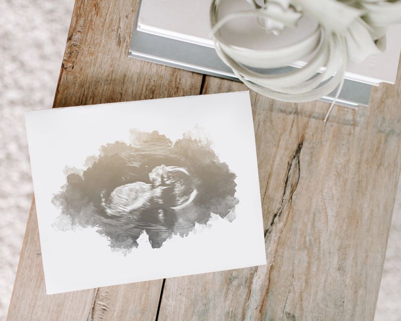 Ultrasound Art with Watercolor Gradient