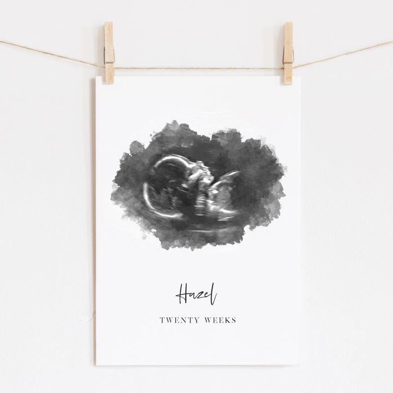 Watercolor Ultrasound Art Print - Portrait