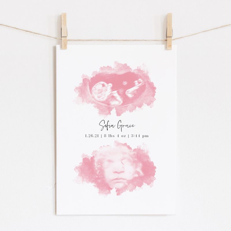 Watercolor Ultrasound Art with Two Images